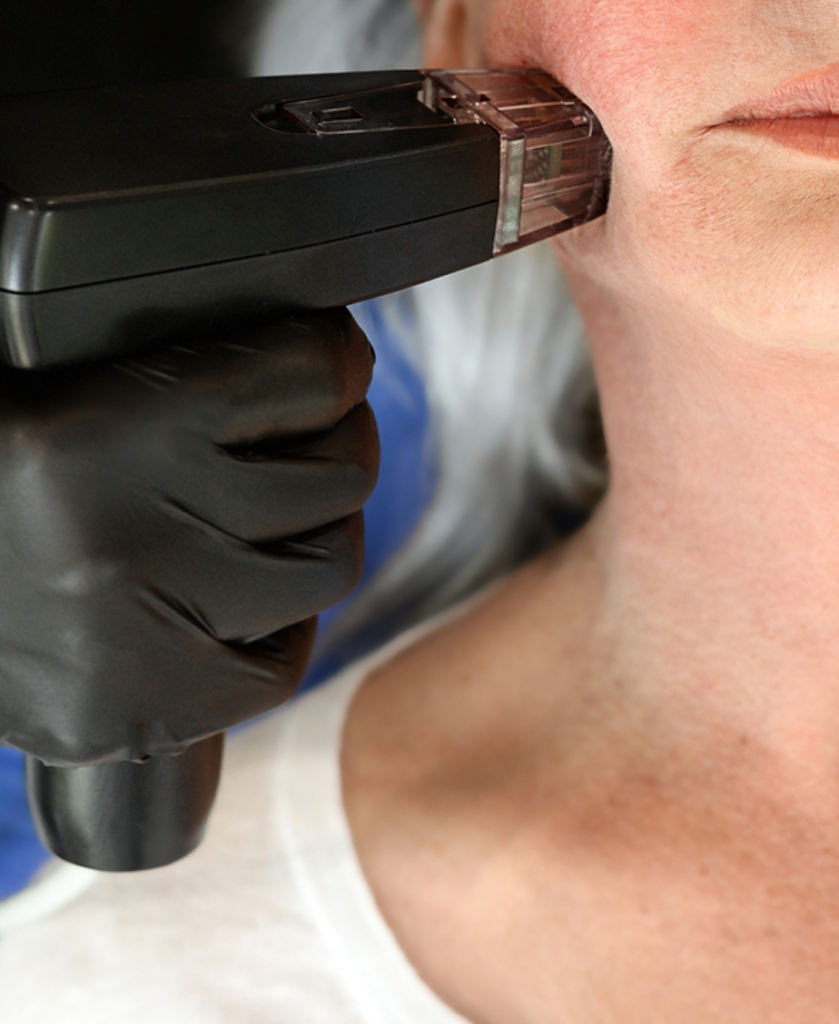 close up skin treatment. beautician treatment
